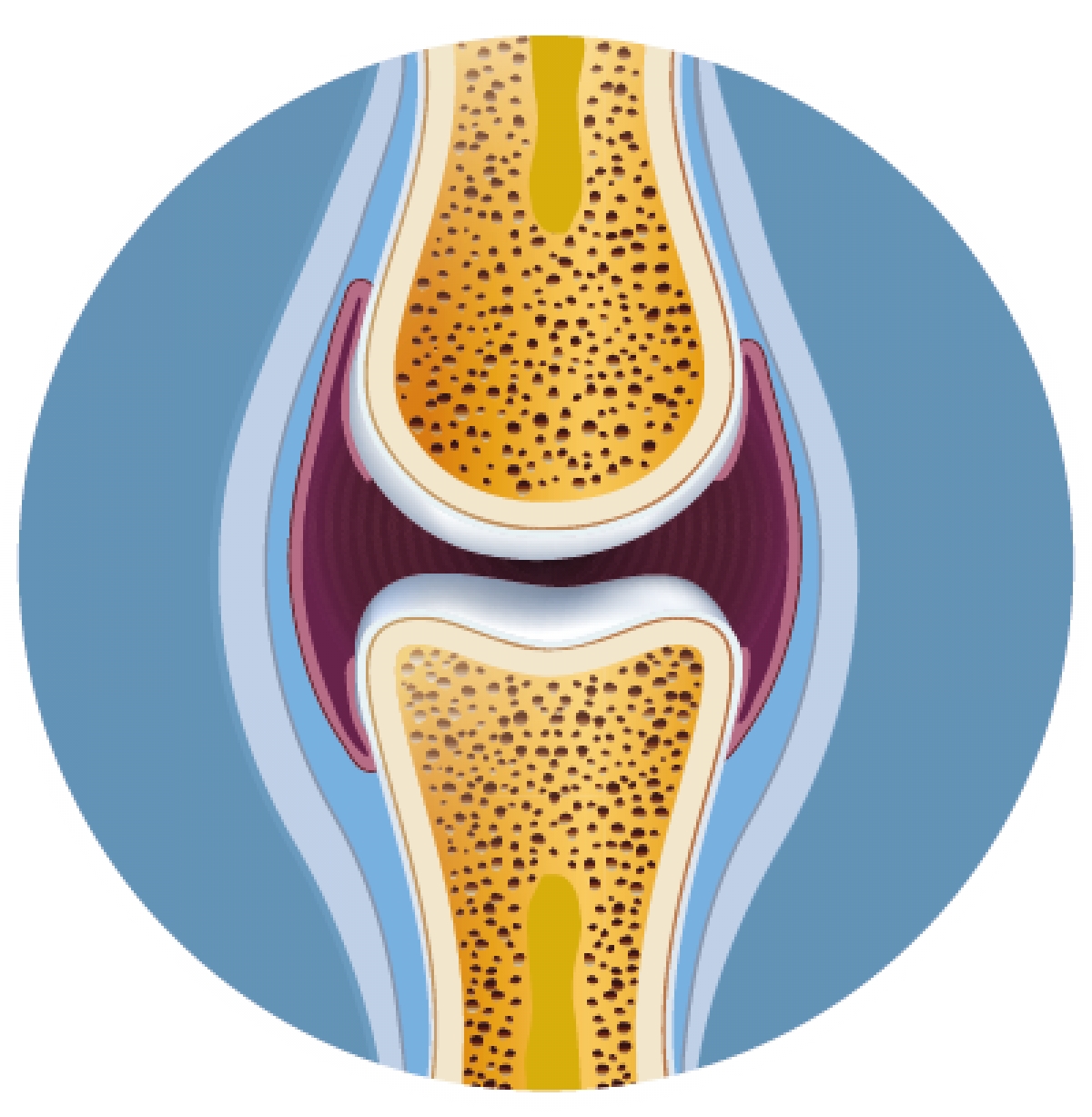 Ossa e osteoporosi: fattori di rischio e strumenti di analisi